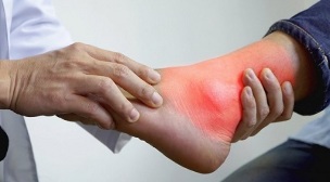 what can and cannot be eaten with gout in the leg